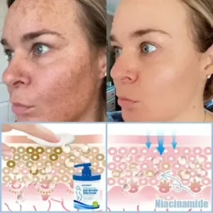 Anti-Wrinkle Skin Cream