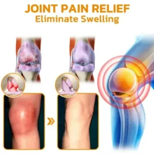 Bee Venom Pain Suppression Joint Healing Cream