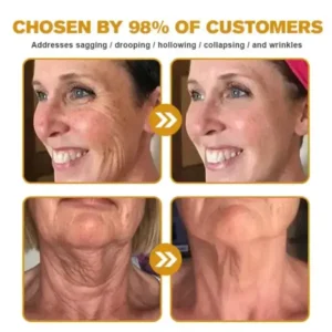 Botox Bee Venom Wrinkle Remover Cream