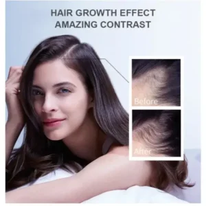 Hair Growth Essence