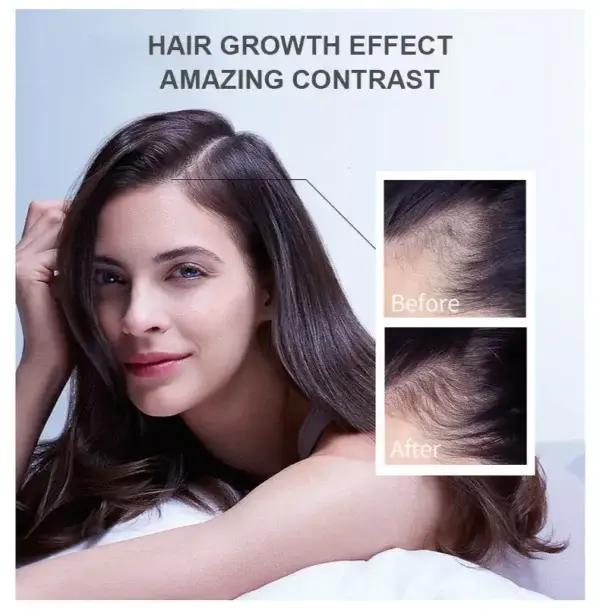 Hair Growth Essence