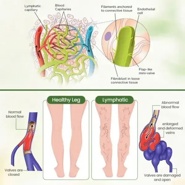 Lymphatic Detox Herbal Cream