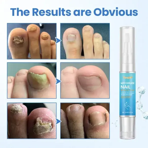 MycoErase Nail Revive Pen