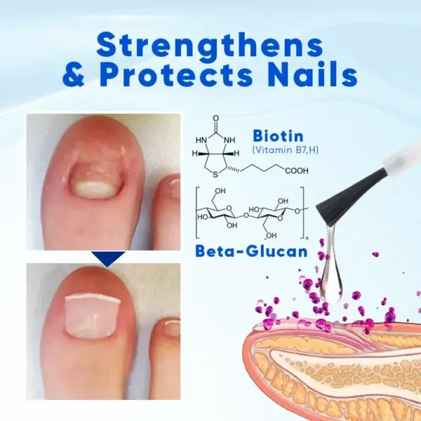 OnyxoGuard Nail Growth and Repair Serum