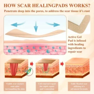 SiliconeFoam Healing Pads