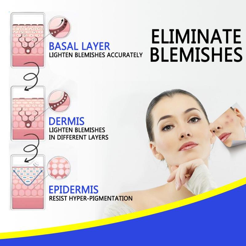 Pro.W Blemish Cream 🎉 BUY 1 GET 1 FREE - Image 5