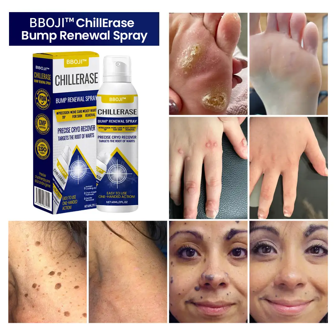 ChillErase Bump Renewal Spray - Image 4