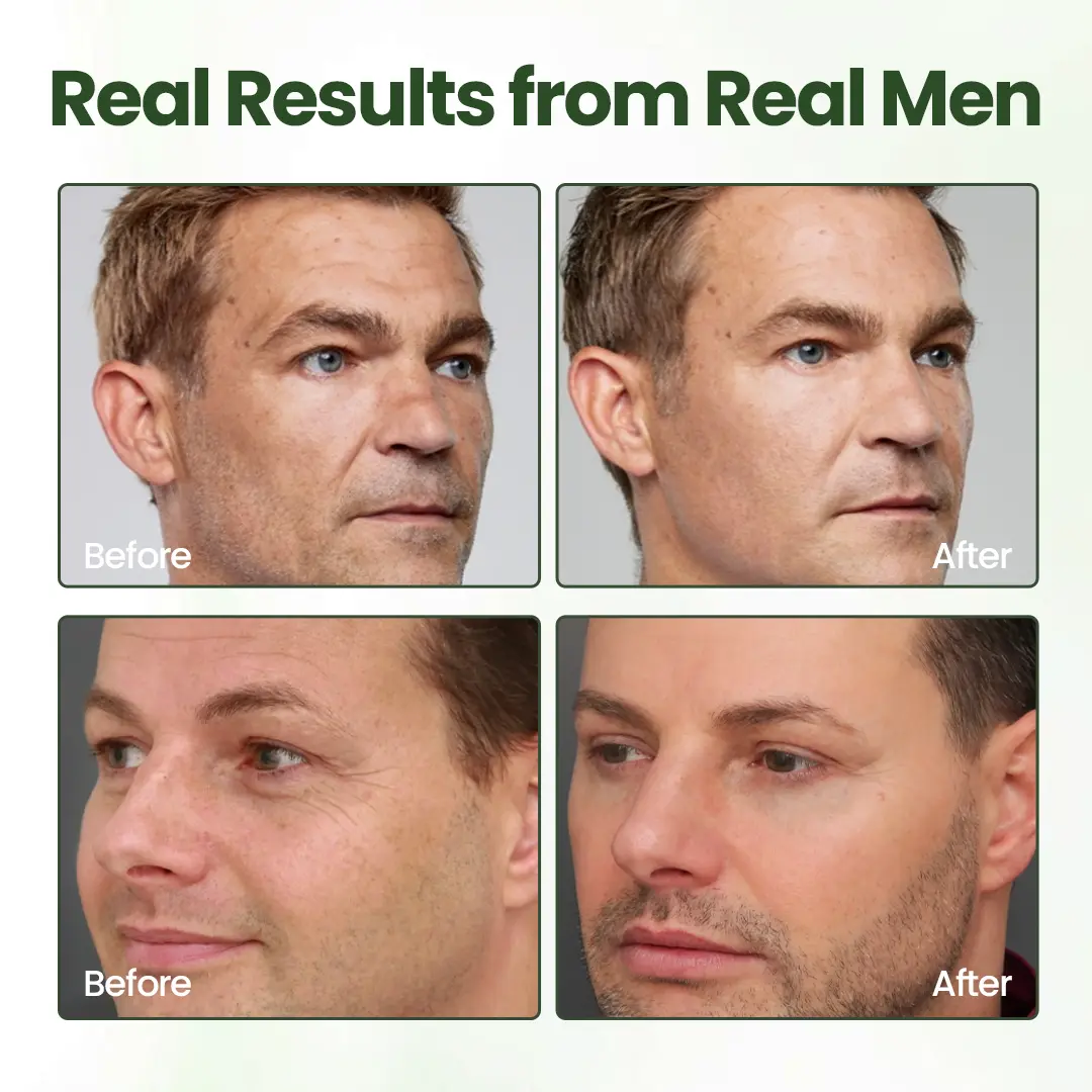 FortiTallow Anti-Wrinkle Balm - Image 2