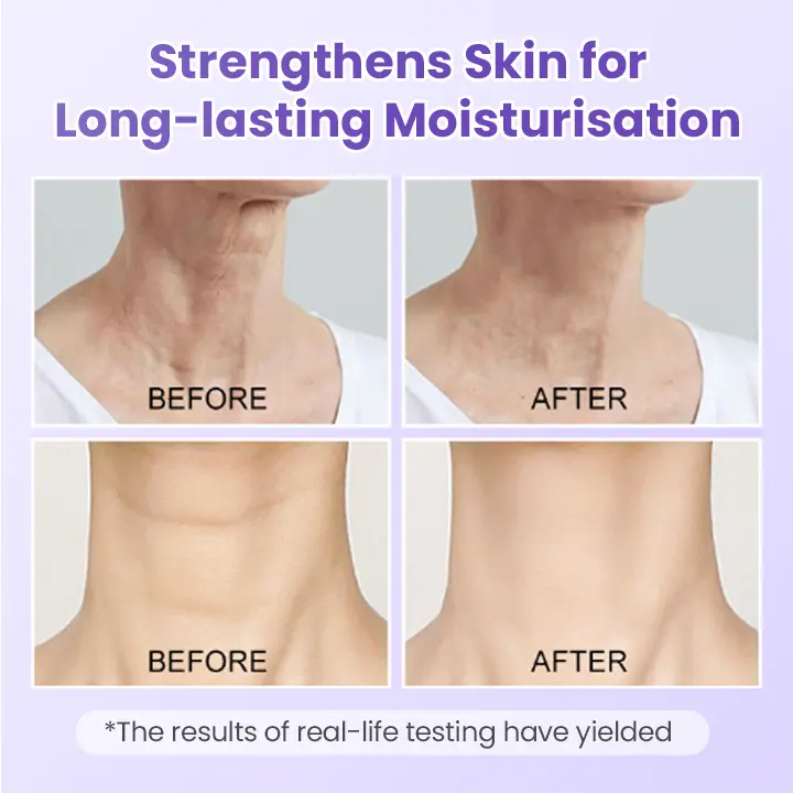 NeckYouth Peptide Anti-Wrinkle Patch - Image 4