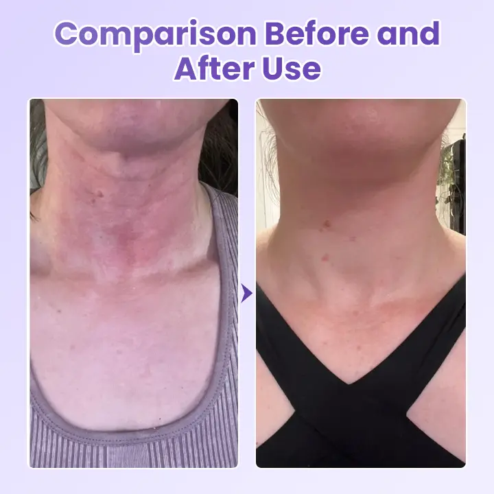 NeckYouth Peptide Anti-Wrinkle Patch - Image 5