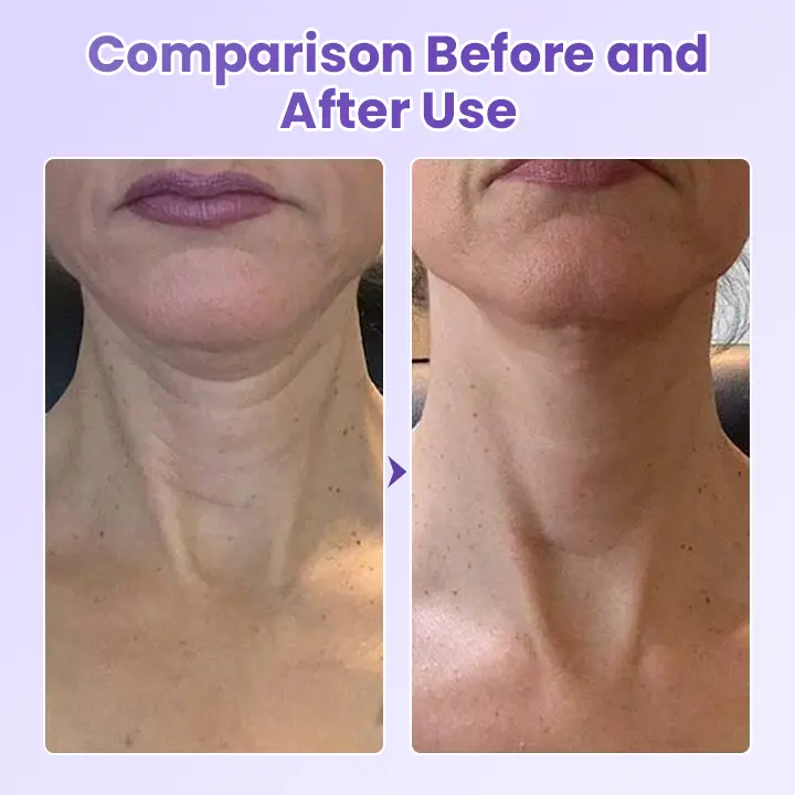 NeckYouth Peptide Anti-Wrinkle Patch - Image 6