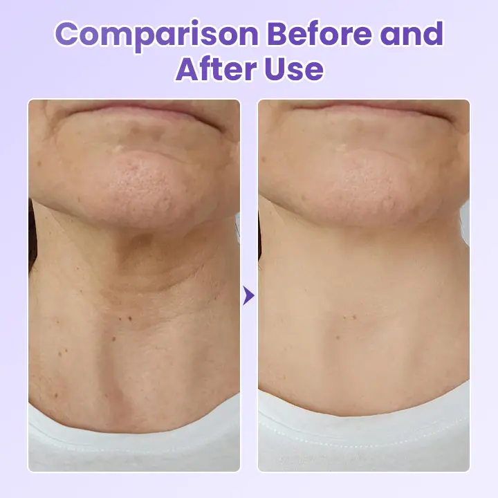 NeckYouth Peptide Anti-Wrinkle Patch - Image 7