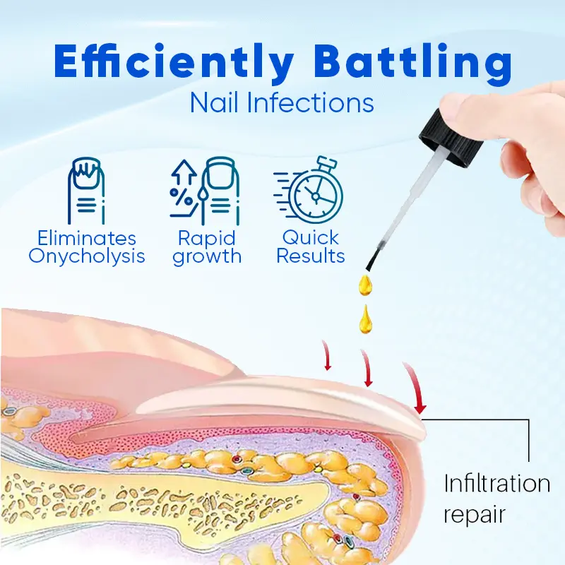 OnyxoGuard Nail Growth and Repair Serum - Image 2