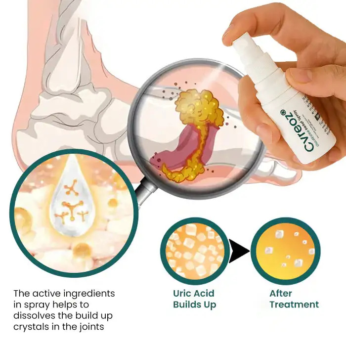 GoutEase Relief Spray - Image 7