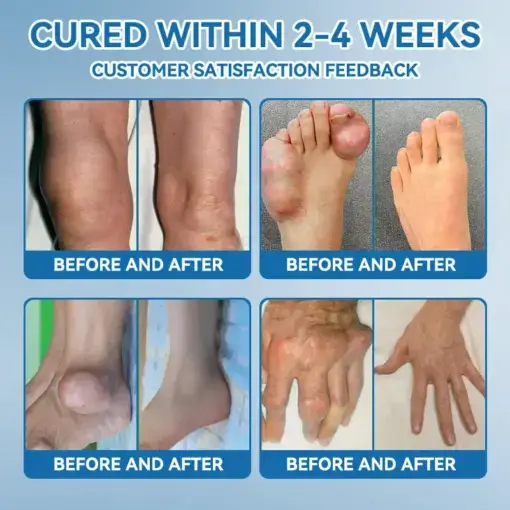 ʙ.ᴘ.ᴄ-157 Joint Healing Cream - Image 5