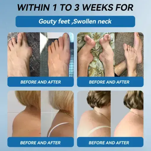 ʙ.ᴘ.ᴄ-157 Joint Healing Cream - Image 4