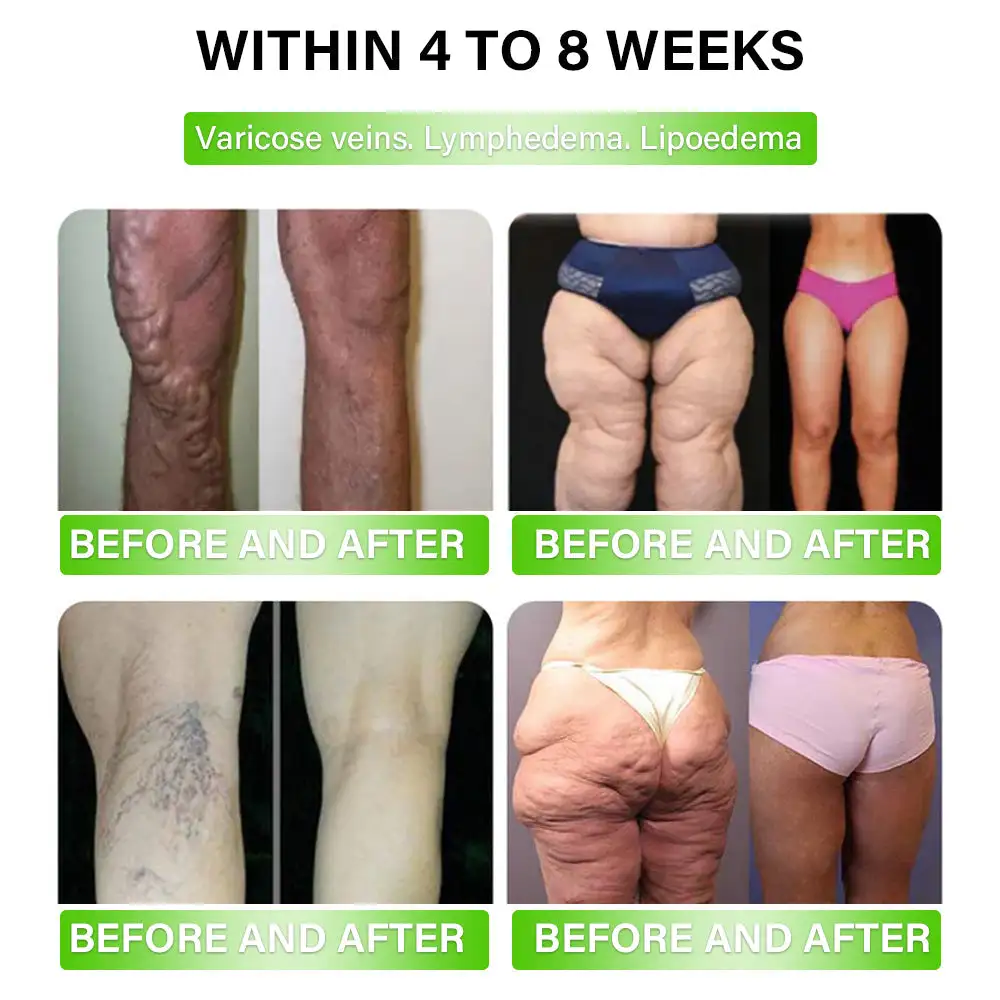 Metabolic Support - Image 5