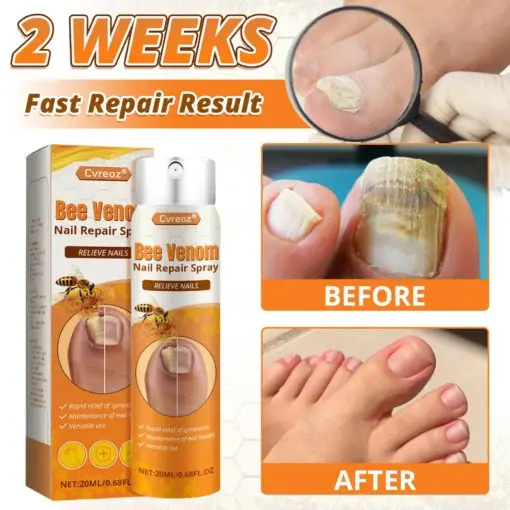Bee Venom Nail Repair Spray - Image 3