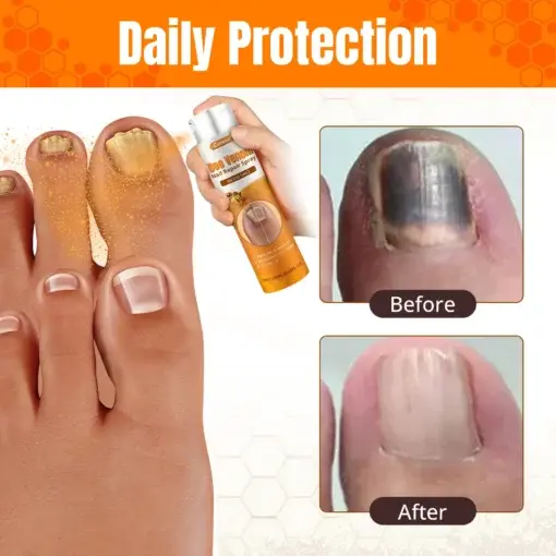 Bee Venom Nail Repair Spray - Image 6