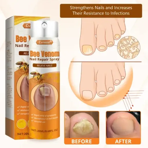 Bee Venom Nail Repair Spray - Image 7