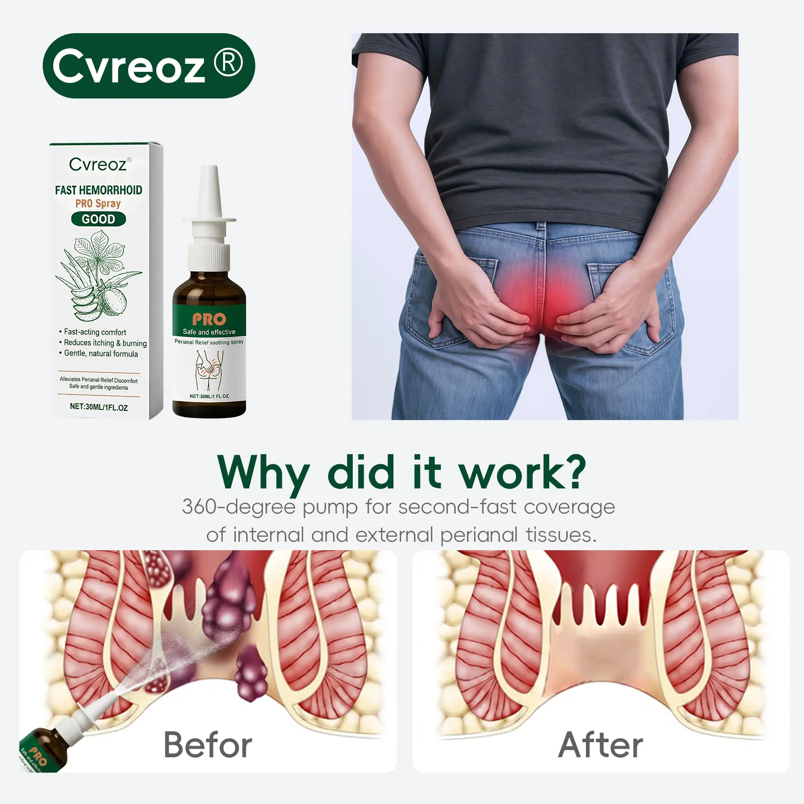 Fast Hemorrhoid PRO Spray - Image 4