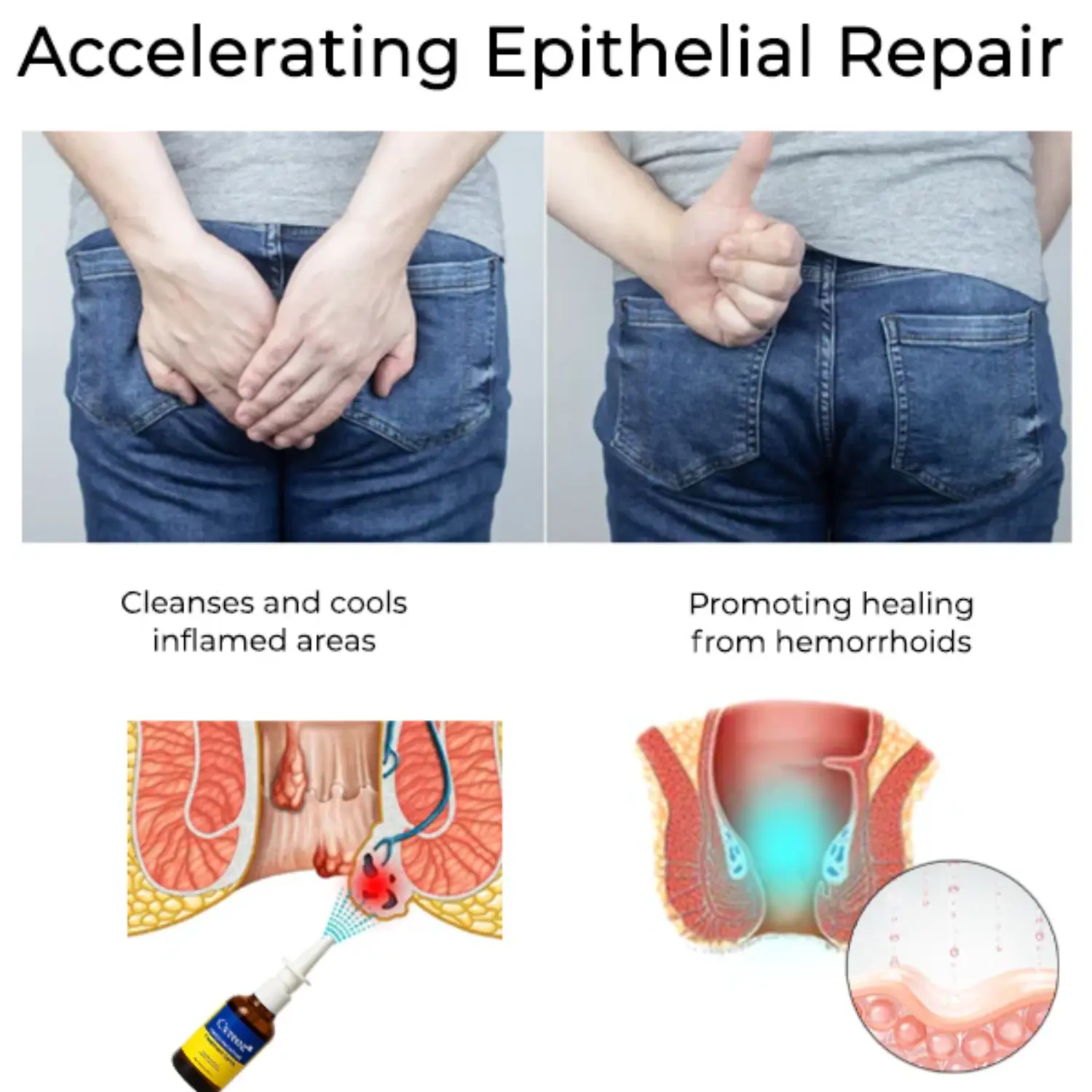 Herbal Hemorrhoid Treatment Anal Spray - Image 3