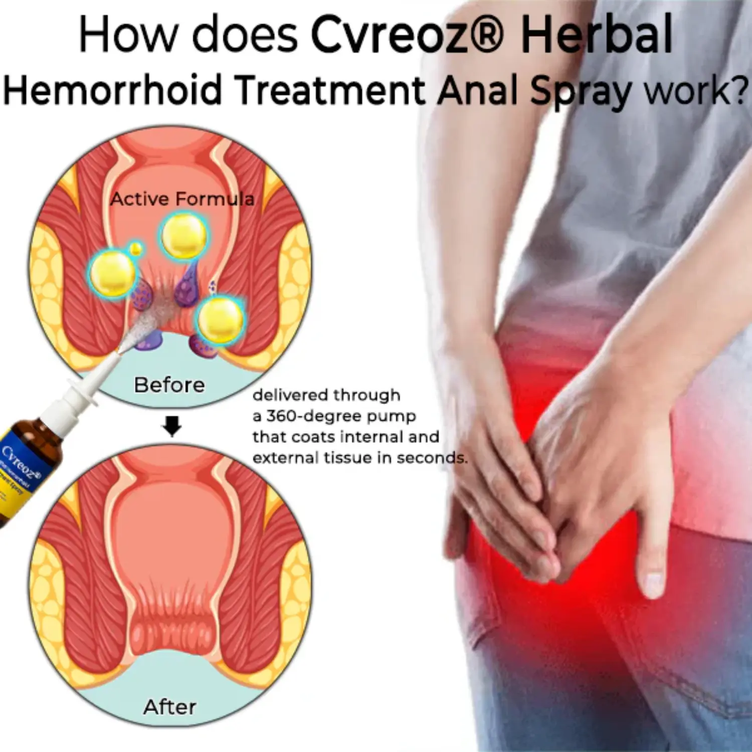Herbal Hemorrhoid Treatment Anal Spray - Image 5