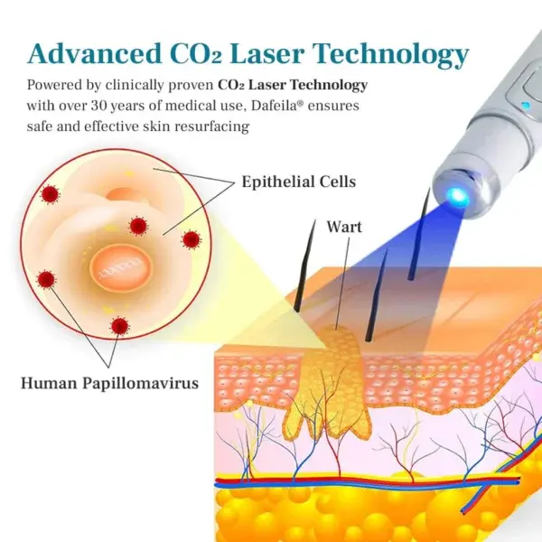 DAFEILA® LumeSkin Mole and Wart Removal Laser Pen - Image 7