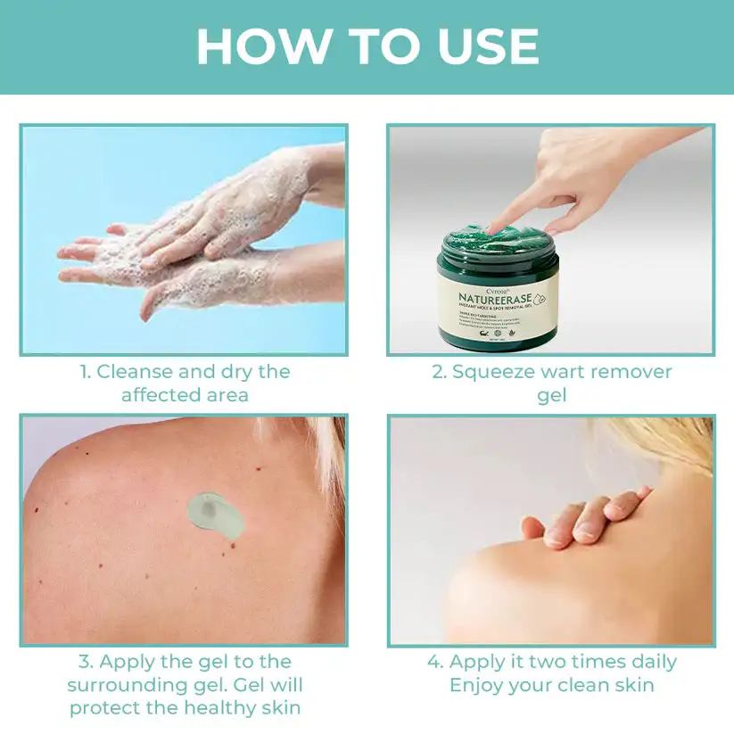 NatureErase Instant Mole & Spot Removal Gel - Image 2