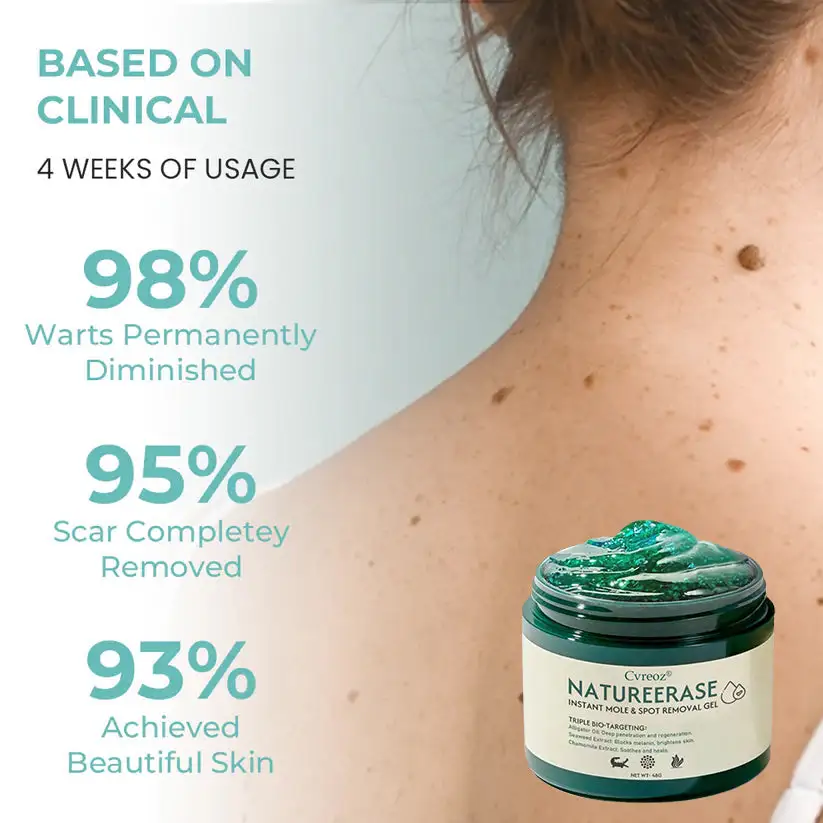NatureErase Instant Mole & Spot Removal Gel - Image 9