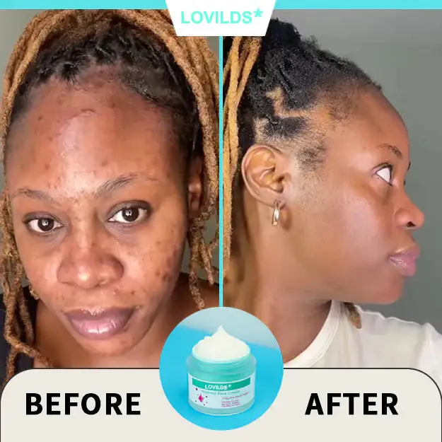Renewal Skin Cream - Image 8
