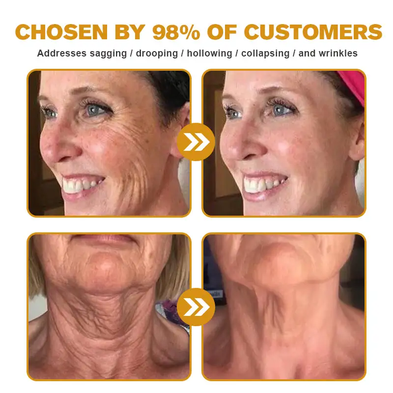 Botox Bee Venom Wrinkle Removal Cream - Image 6