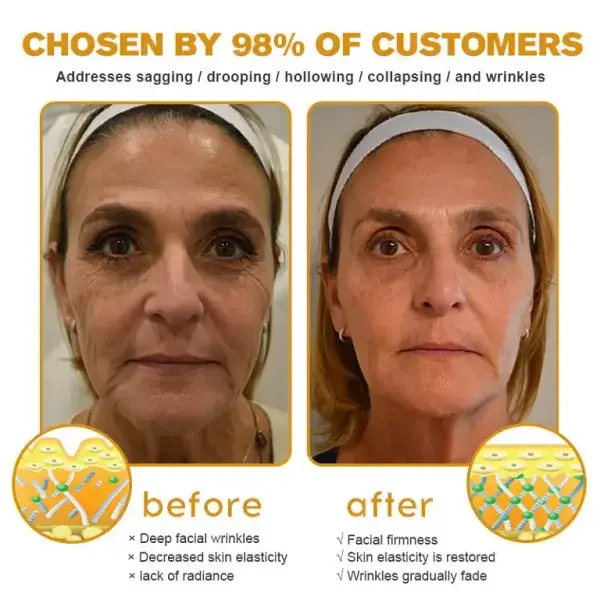 Botox Bee Venom Wrinkle Remover Cream - Image 4
