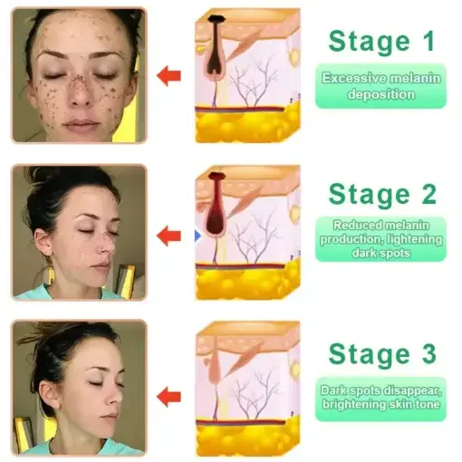 Purifying Exfoliating Gel for Acanthosis Nigricans - Image 10