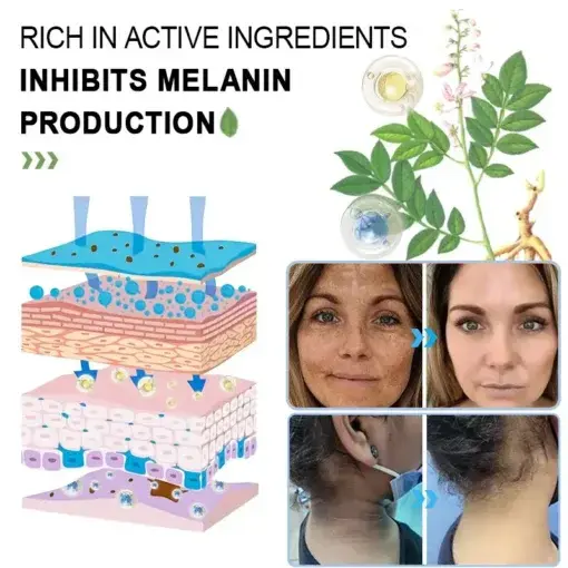 Purifying Exfoliating Gel for Acanthosis Nigricans - Image 7
