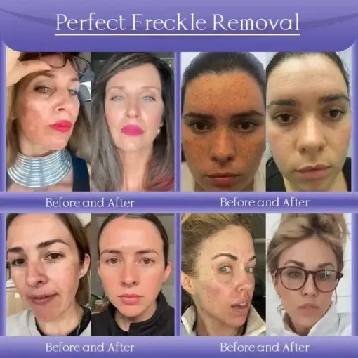 Skin Firming & Anti-Wrinkle Cream - Image 4