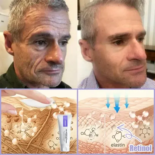 Skin Firming & Anti-Wrinkle Cream - Image 6