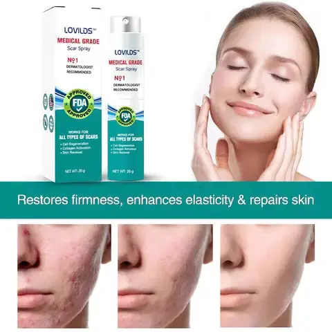 Advanced Scar Spray For All Types of Scars - Image 6