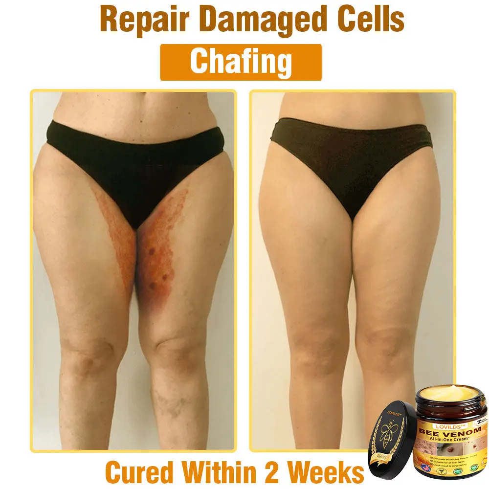 Bee Venom All-in-One Cream US Dermatologist Approved - Image 7