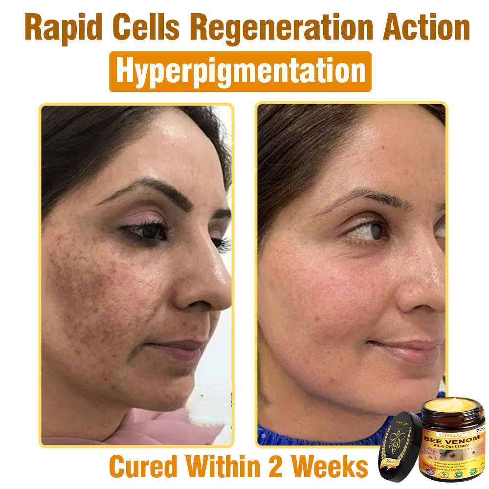 Bee Venom Cream – Anti-Aging Hydrating & Skin Repair - Image 14