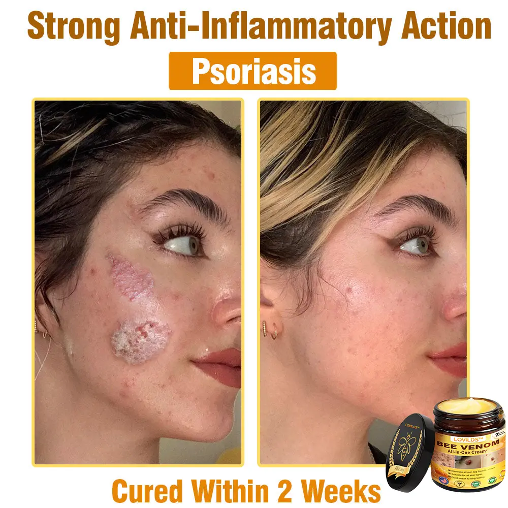 Bee Venom Cream - Image 16