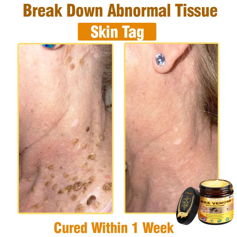 Bee Venom Cream - Image 18