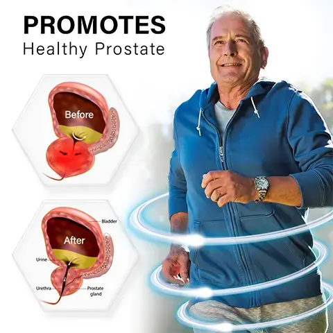 BeeProsta Nasal Spray for Prostate Wellness - Image 6