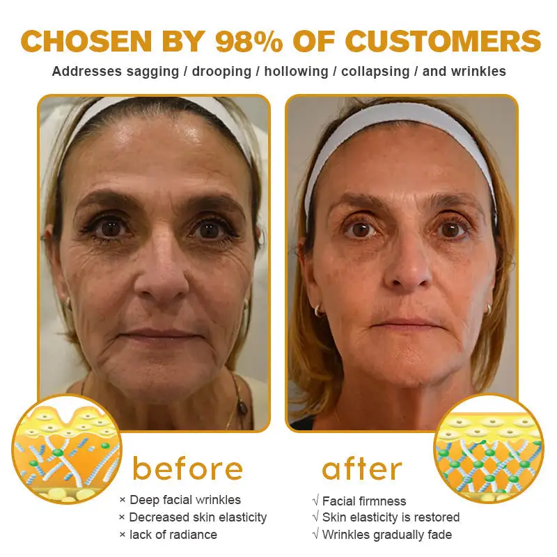 Botox Bee Venom Wrinkle Removal Cream - Image 9