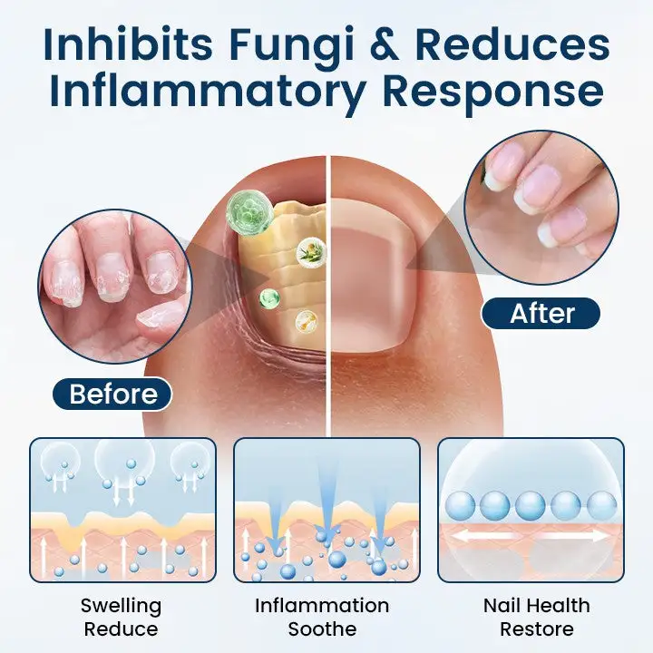 Fungal Repair Herbal Spray - Image 3