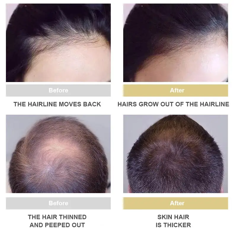 Hair Growth Essence - Image 7