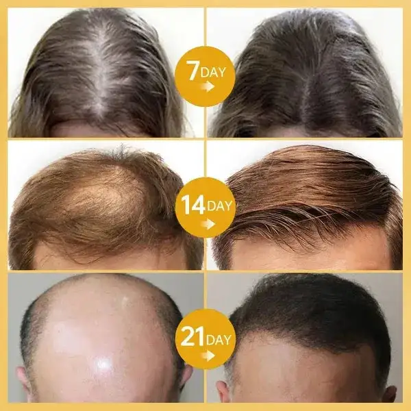 Hair Growth Essence - Image 8