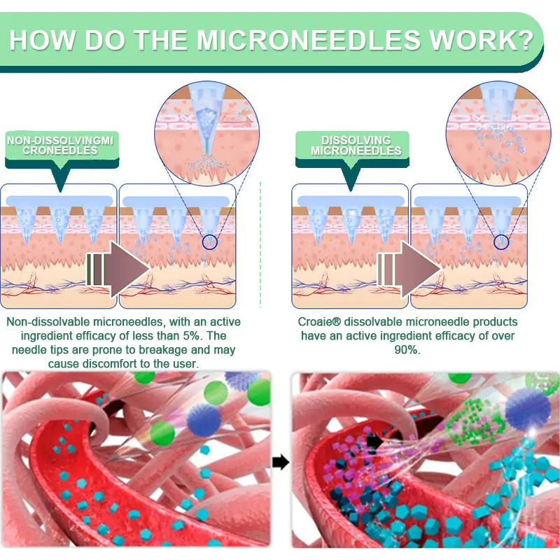 SIX IN-ONE NIDDK-Tirzepatide Health NANO MICRONEEDLE PATCH - Image 10