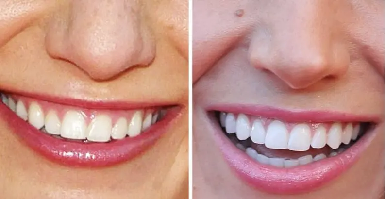 Advanced Dental Care Toothpaste - Image 4