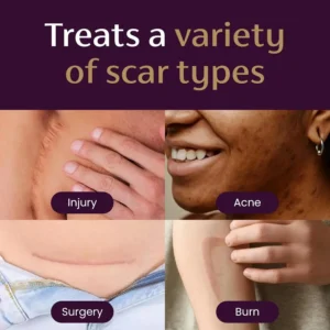 Alternative view of Advanced Scar Gel